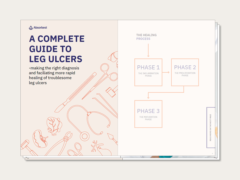 A guide to manage and treat leg ulcers