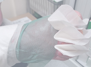 Clinical Outcomes in the Management of Toe Lymphorrhoea with a Superabsorbent Dressing