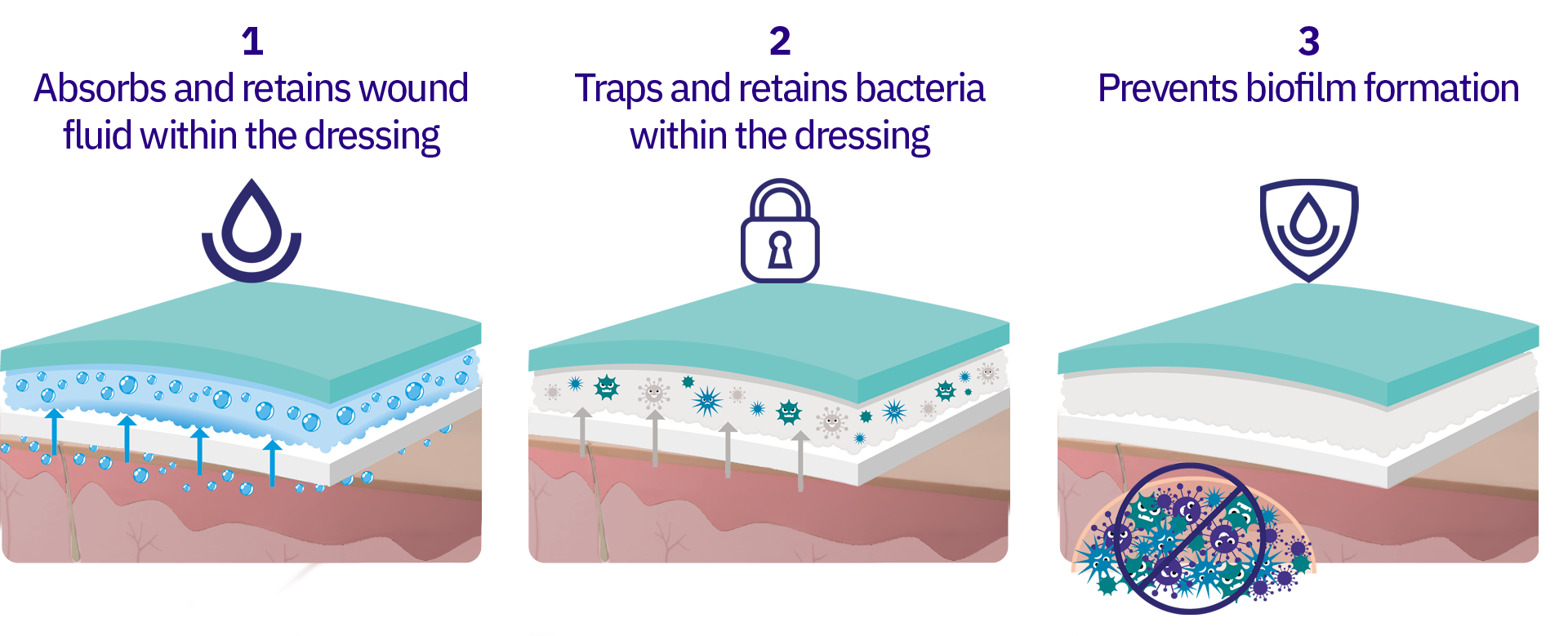 Absorbest Bioshield: How it works?