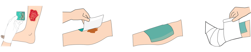 Absorbest BioShield appliceringsguide